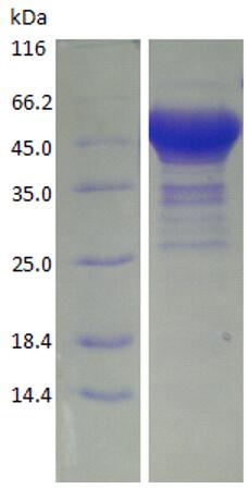 15% SDS-PAGE analysis profiles of purified KP1_0953-31-500 (CBB stained).